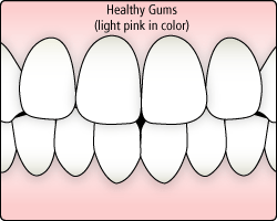 healthy-gums